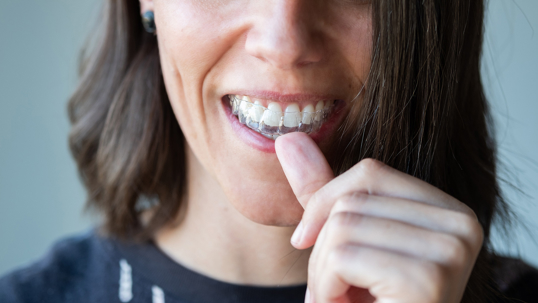 What to Know About Getting Invisalign