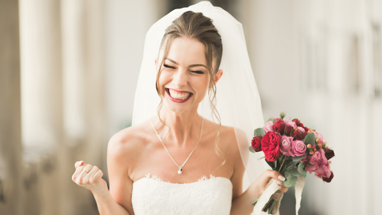 When to Start Invisalign Before Your Wedding Day