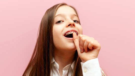 Why Do My Teeth Feel Loose with Braces?