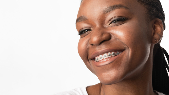 Why Summer Vacation Is a Great Time to Get Braces